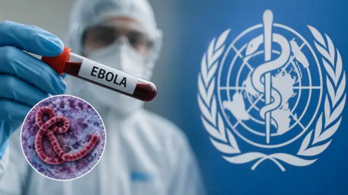 Ebola Virus